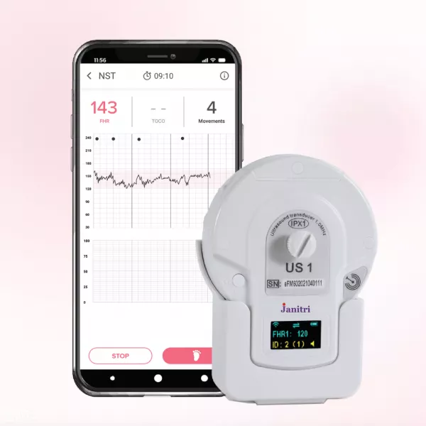 Keyar DT Lite - Home Nonstress Test (NST) on rent